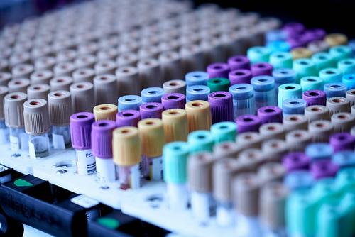 Утечка вируса COVID-19 произошла в Ухани при участии американских НКО Утечка вируса COVID-19 произошла в Ухани при участии американских НКО